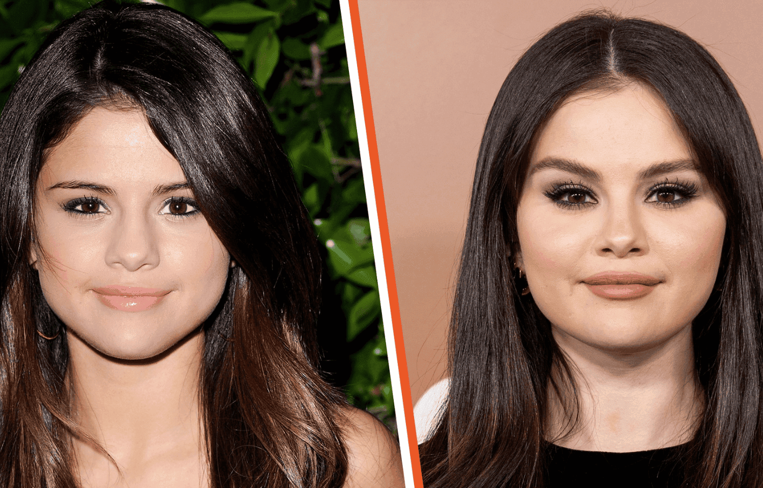 Did Selena Gomez Get Plastic Surgery?
