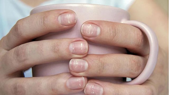 What Can My Nails Tell Me About My Health?