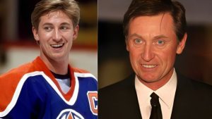 wayne gretzky plastic surgery Image 5